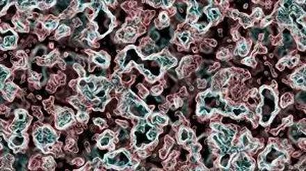 E. Coli Prevention in Chicago Beach Waters