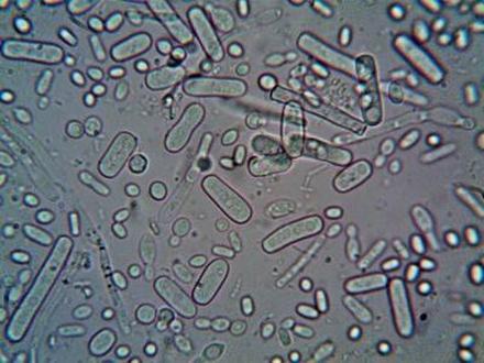 types-of-E.-coli.jpg