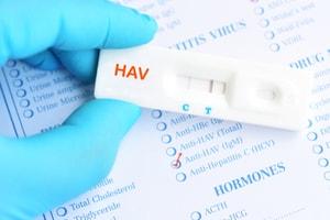 How Hepatitis A Outbreaks Occur at Restaurants