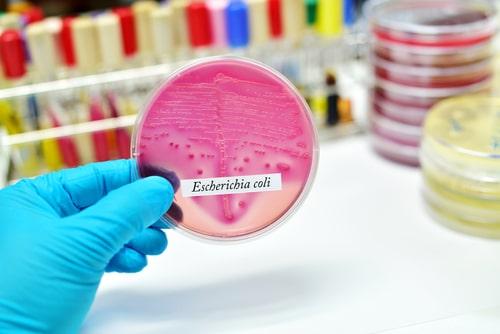 Illinois E. coli poisoning attorney