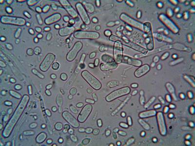 b2ap3_thumbnail_types-of-E.-coli.jpg